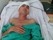 Làng sao - Diễn viên Nguyễn Hoàng dần hồi phục sau ca ghép hộp sọ