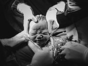 Bà bầu - Ngắm chi tiết ca sinh mổ tuyệt đẹp của mẹ bầu Hà Nội