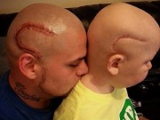 Làm mẹ - Câu chuyện cảm động đằng sau "vết sẹo" giống nhau của hai bố con