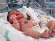 Làm mẹ - Em bé suýt tử vong vì người lớn không rửa tay trước khi bế