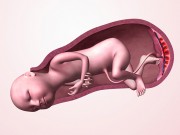 Bà bầu - 5 lý do khiến bé bị mắc kẹt trong tử cung mẹ khi sinh