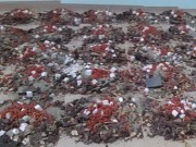 Tin tức - Người đàn ông bị phù người, suy thận vì chữa vô sinh bằng đông y