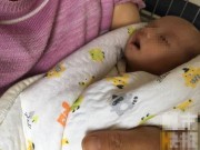 Bà bầu - Bé sơ sinh vừa chào đời đã mang bào thai trong bụng gây sốc