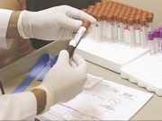 Tin tức - Thử nghiệm thành công vắc xin chống virus Zika trên động vật