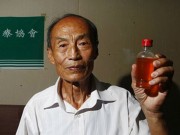 Tin tức - Người đàn ông TQ uống nước tiểu của mình suốt 23 năm