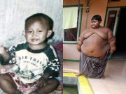 Làm mẹ - Hình ảnh khó tin trước và sau 8 năm của cậu bé béo nhất thế giới