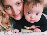 Làm mẹ - Gương mặt đẹp của bé 11 tháng bị down được ký hợp đồng làm người mẫu