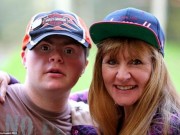 Tin tức - Chàng trai bị down có hơn 60.000 người hâm mộ