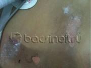 Tin tức - Bị sét đánh, mẹ con thai phụ được cứu sống kỳ diệu