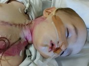 Làm mẹ - Bé 8 tháng bất động vĩnh viễn vì nuốt phải pin