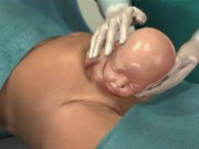 Bà bầu - Video: Xem từng bước một ca sinh mổ