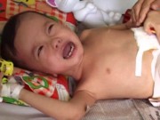 Tin tức - Bé trai 3 tuổi bị đánh vỡ đại tràng từng bị bạo hành?