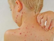 Nhà đẹp - 7 tác nhân lớn trong nhà khiến trẻ dị ứng