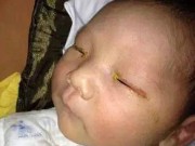 Làm mẹ - Trung Quốc: Bé 3 tháng tuổi mù mắt vì đèn flash máy ảnh