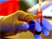 Tin tức - 260 ngàn người nhiễm HIV đang sống tại tất cả các tỉnh thành VN