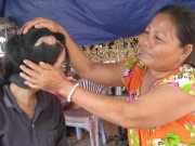 Tin tức - Gặp lại bé gái bị máy ép mía lột sạch da đầu