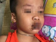 Tin tức - Trẻ uống nhầm hóa chất, thuốc chuột: Người lớn hãy tự trách mình