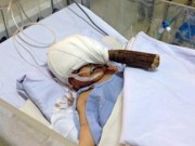 Tin tức - Vụ bé sơ sinh bị đâm xuyên não: "Con tôi có tội tình gì?"