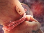 Bà bầu - Dây rốn quấn cổ: Không hề nguy hiểm như mẹ nghĩ