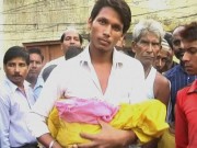 Tin tức - Ấn Độ: Trẻ sơ sinh tử vong vì bác sĩ 'quên' đầu trong bụng mẹ