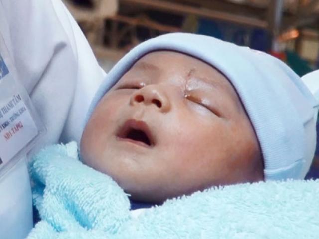 20 ngày vượt ải sinh tử của bé trai bị dao đâm xuyên đầu