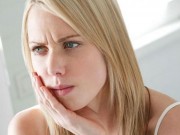 Sức khỏe - Cách chữa nhiệt miệng đơn giản mà hiệu quả nhất