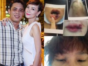 Làng sao - Dương Yến Ngọc tố bị chồng cũ đánh đập, hành hung