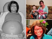 Bà bầu - Chuyện sinh con kỳ diệu của mẹ mắc bệnh da vảy cá