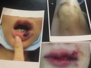 Làng sao - Công an đang xác minh vụ Dương Yến Ngọc bị bạo hành