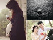 Bà bầu - Chồng viết tâm sự về những vết rạn da của vợ gây xúc động