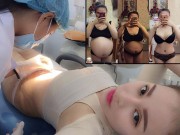 Bà bầu - 9x hai con kể chuyện đi cắt mỡ thừa ở bụng sau sinh