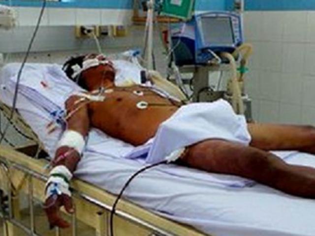 Bệnh nhân nhiễm liên cầu lợn do ăn tiết chưa nấu kỹ đã tử vong