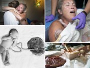 Bà bầu - Ảnh mẹ đau đớn khi đẻ thường ‘chạm đến tim’ người xem