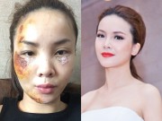 Làng sao - Yến Trang xinh đẹp khác lạ sau tai nạn nghiêm trọng