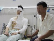 Tin tức - Nghi án nam sinh bị tạt axit vì chuyện tình cảm