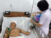 Tin tức - Tìm người thân của bệnh nhân gặp tai nạn giao thông