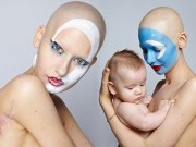 Làm đẹp - Người mẫu ung thư chấp nhận xấu xí để sinh con