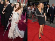 Làng sao - Sao Hollywood đeo nạng đến thảm đỏ vì chấn thương