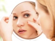 Sức khỏe - 6 bí quyết cực kỳ đơn giản giúp ngăn ngừa mụn