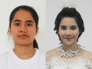 Làm đẹp - Cô gái mặc cảm về ngoại hình đổi đời nhờ phẫu thuật thẩm mỹ