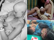 Bà bầu - Ảnh mẹ bị cắt ngực, cụt chân tay vẫn cho con bú khiến dân mạng nghẹn lòng