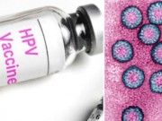 Tin tức - Thực hư vắc xin HPV không có hiệu quả phòng ung thư cổ tử cung