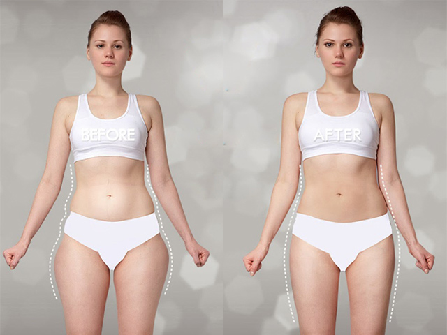 4 bài tập giúp bạn thoát mác cô gái chân voi