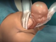 Bà bầu - Xem tận mắt ca mổ bắt con “nhanh trong chớp mắt”