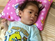 Tin tức - Điều gì làm nên sự thay đổi kinh ngạc của bé gái 14 tháng tuổi nặng 3,5 kg?