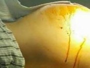 Bà bầu - Nghi mang thai nhiều tháng không đẻ, nữ sinh 14 tuổi ngất vì thứ lôi ra từ bụng