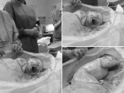 Bà bầu - Không cần bác sĩ hỗ trợ, bé sinh mổ tự nhúc nhích ra khỏi bụng mẹ