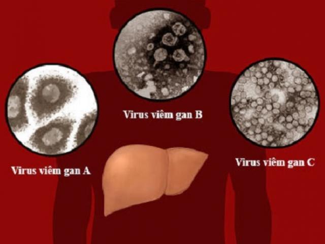 Bệnh viêm gan mỗi năm cướp đi sinh mạng của 1,4 triệu người