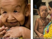 Tin tức - Xót xa nụ cười của cậu bé 4 tuổi trong hình hài ông lão 80