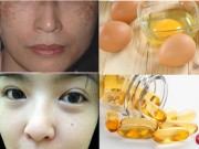 Làm đẹp - 1 quả trứng gà xóa mờ tàn nhang, đẩy tone da lên sáng hồng